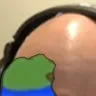 LifeBald
