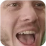 HA
