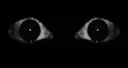 eyes