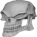 deformedskull