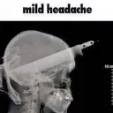 Mildheadache Discord Emoji