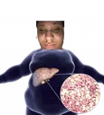 littlefattyliver