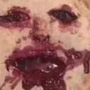 agony agony