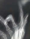 chaeynzhand Discord emoji