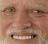 somnenie Discord Emoji - Бальзам
