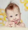 chinesedownsyndromebaby