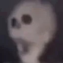 skulliosis