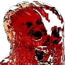 testicular_torsion