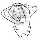 Agony