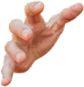Hand1