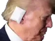 trump_ear_bandage