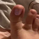toe