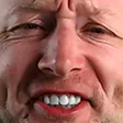 limmyCharlie limmyCharlie