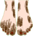 :Elsies_Dirty_Feet: