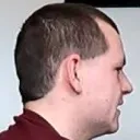 BaldFire
