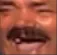 44