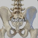 :DeadAss: