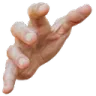 Hand1