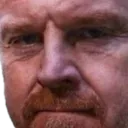 sean_dyche