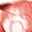 BpRagea2