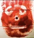 wilson
