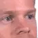whatBlink