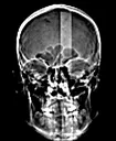 ejayskull