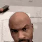 bald