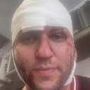 A man with a white bandage wrapped around his head and visible facial injuries looking directly at the camera.