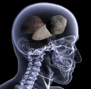 rocks