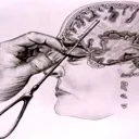Lobotomy