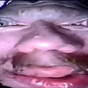 bulbous