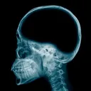 brainless
