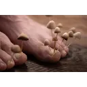 Foot_Fungus