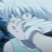 tr3_killua_slapped
