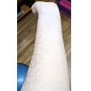 arm