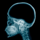 nobrain custom emote from Failed Abortions pt.3
