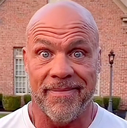 A bald man with a serious expression and wide, unblinking eyes staring directly into the camera.