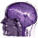 Brain MRI scan with a bright electric spark running through the center.