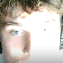 A close-up of a person's face with extreme overexposure, focusing on a single blue eye and a confused expression.