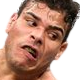 A man with a pained, wincing expression as if he was just hit in the face.