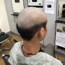 A person with a severely botched buzz cut showing a stark contrast between shaved and unshaved hair.