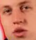 FeelsBaldMan