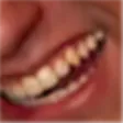 lol