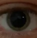 auge