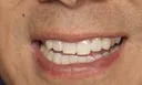 teeth