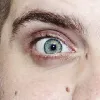 lemoneye1