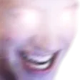 hyperohyes