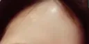 n5head
