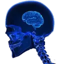 braincompression